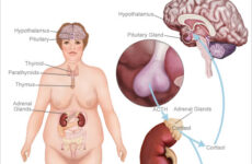 relación entre cortisol y obesidad
