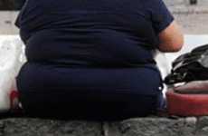 obesidad mórbida