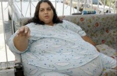 Mujeres con obesidad mórbida. Una especial amenaza para la salud
