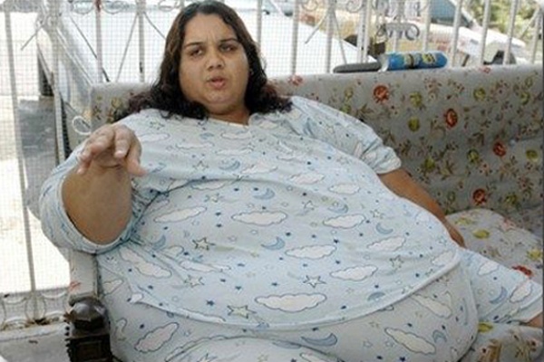 Mujeres con obesidad mórbida. Una especial amenaza para la salud